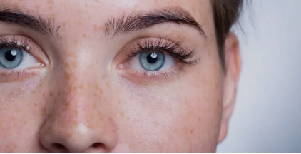 lasik eye surgery